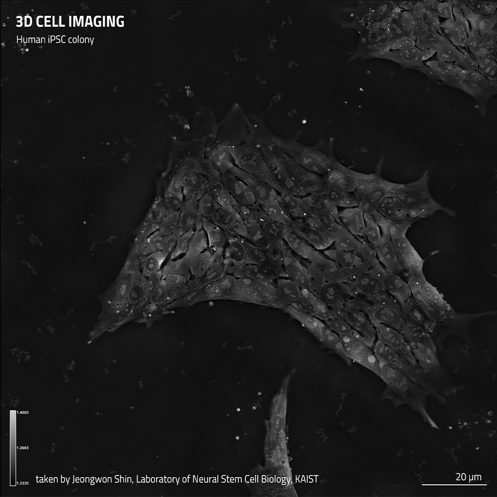 {HT-X1_Stem-cell_iPSC_01.png}