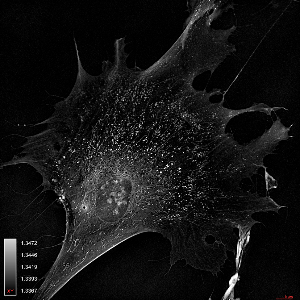{HT_X1_Fibroblast_HS68_01.png}