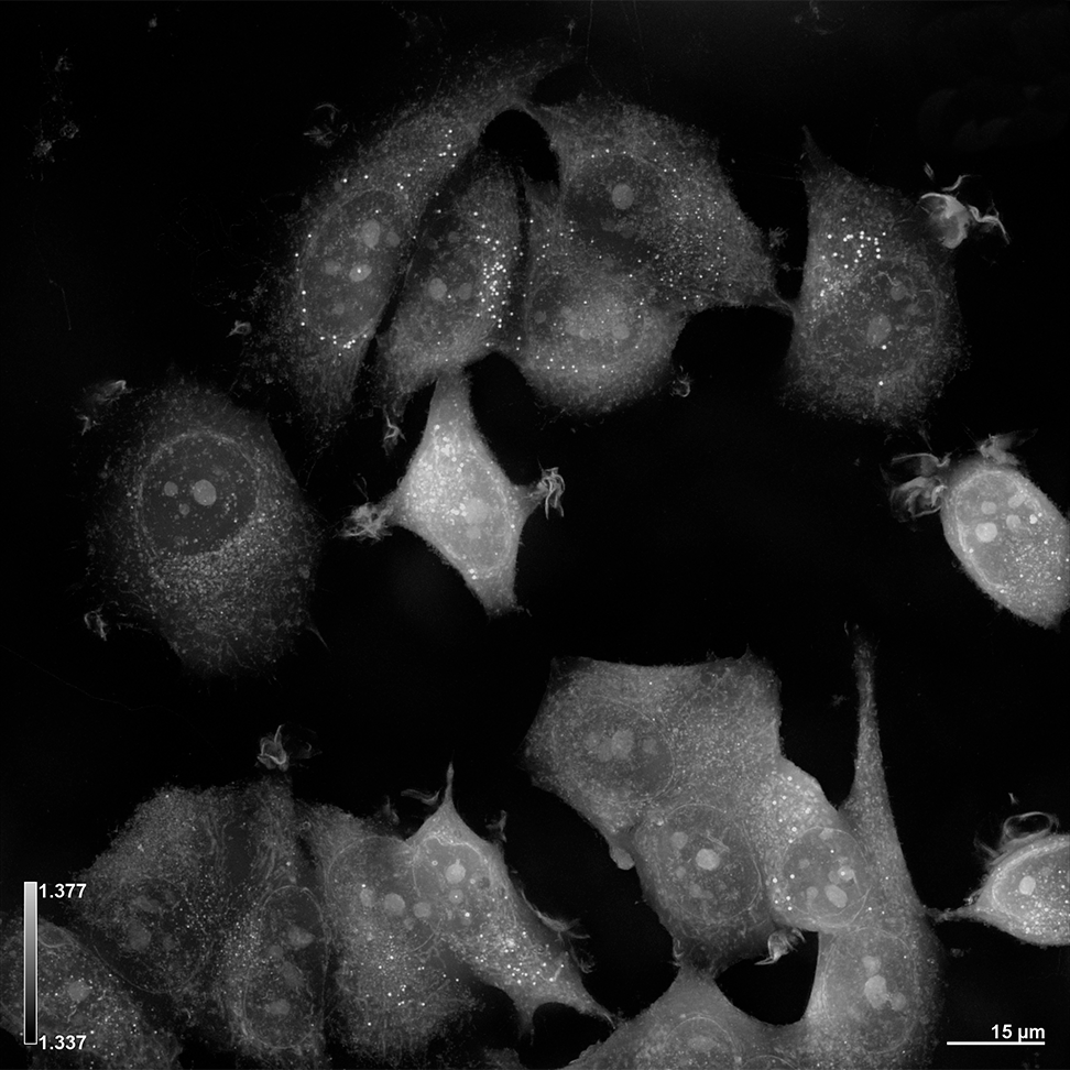 {HT-X1_Breast-cell_MCF7_01.png}