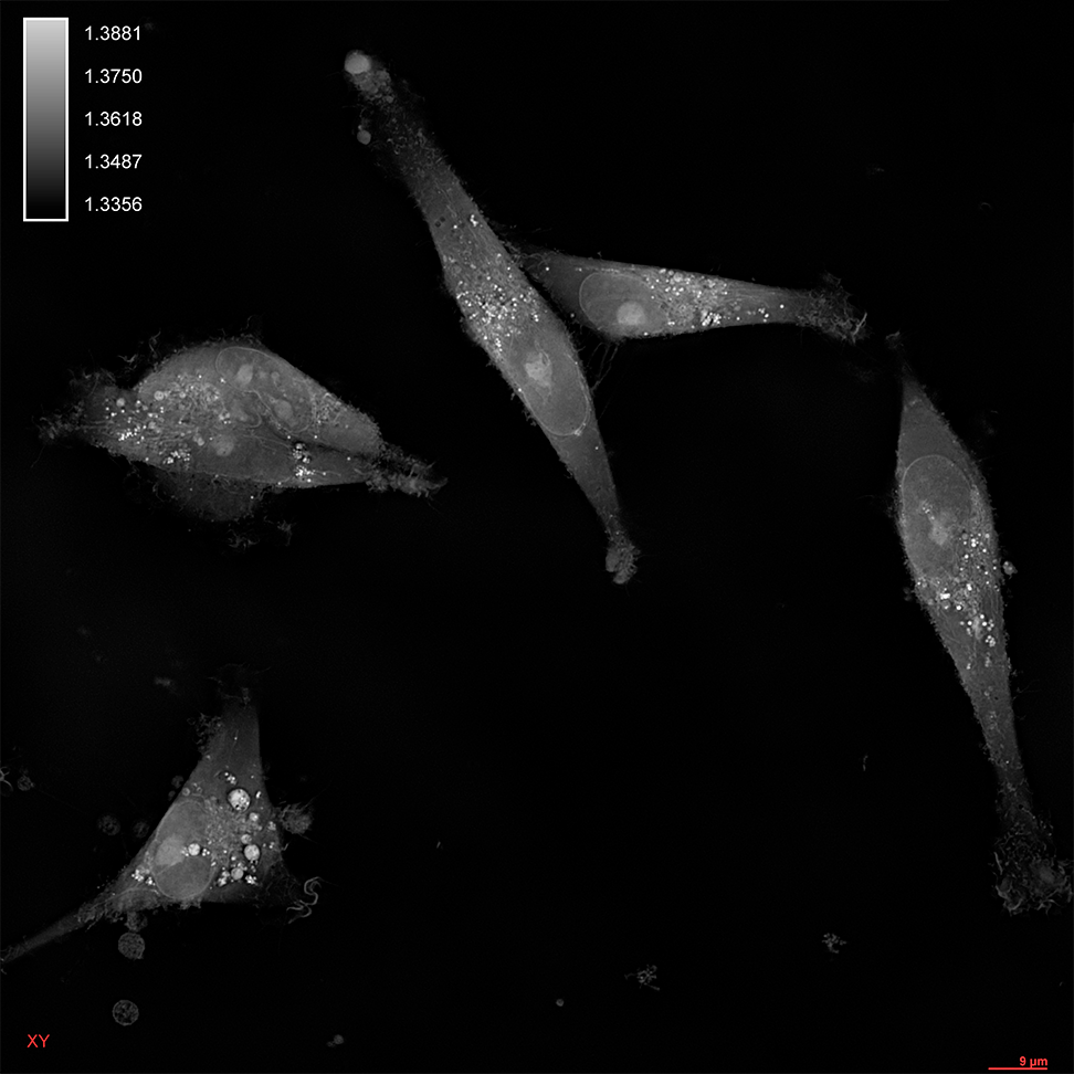 {HT-X1_Breast-cell_MDAMB231_01.png}