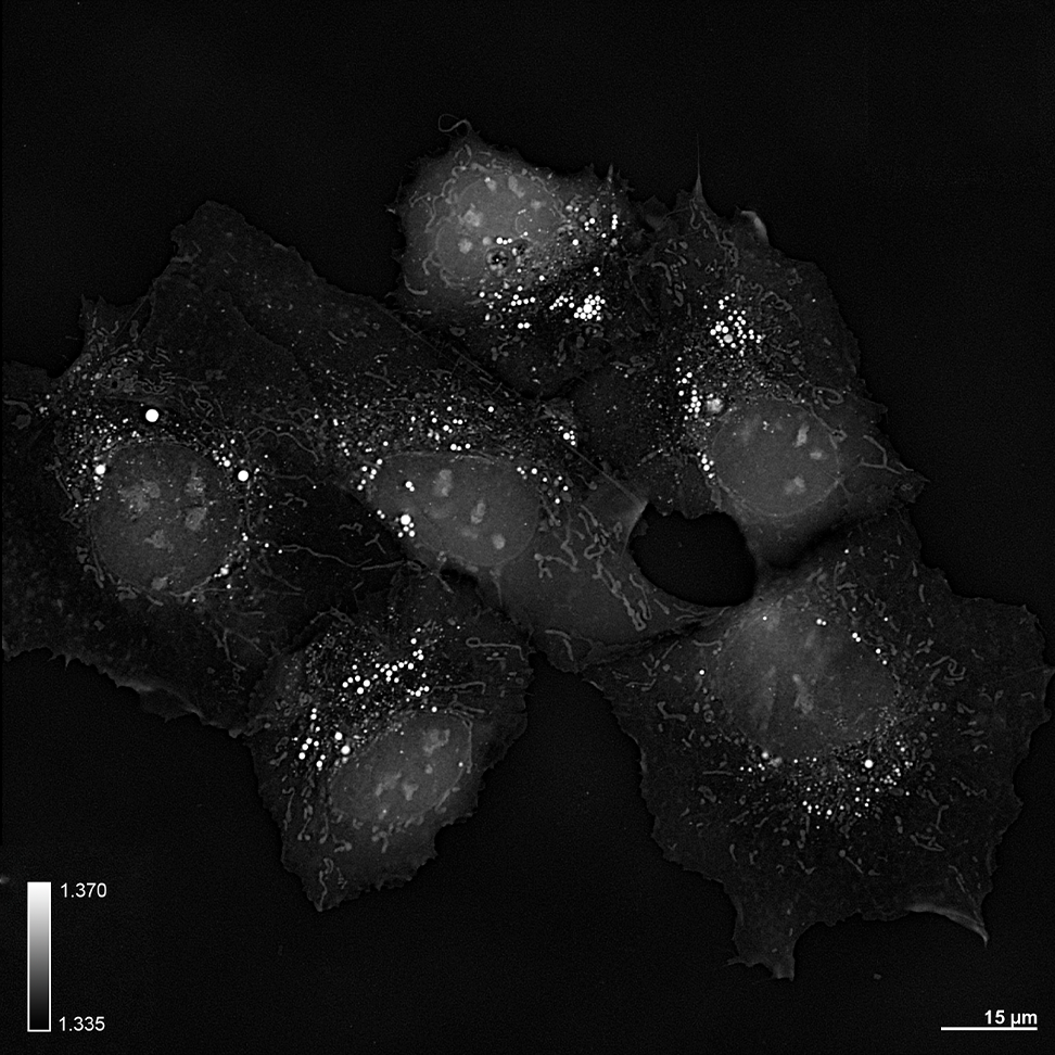 {Liver-cell-Hep3B.png}