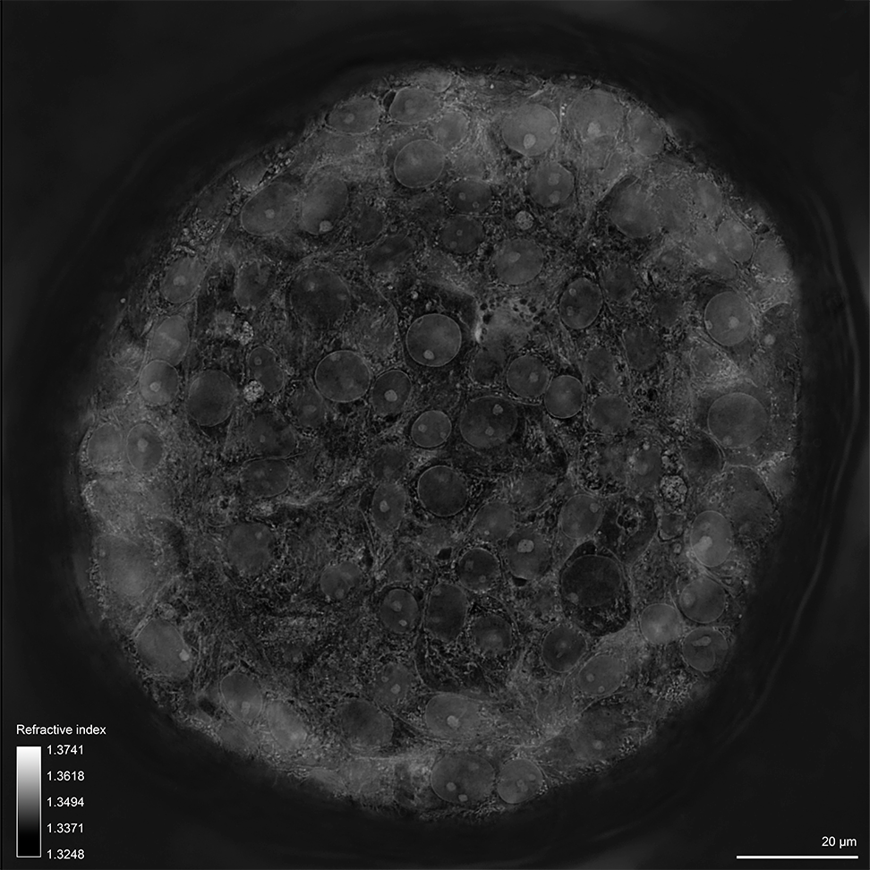 {HT-X1_Organoid_Lung_02_xyplane25.png}
